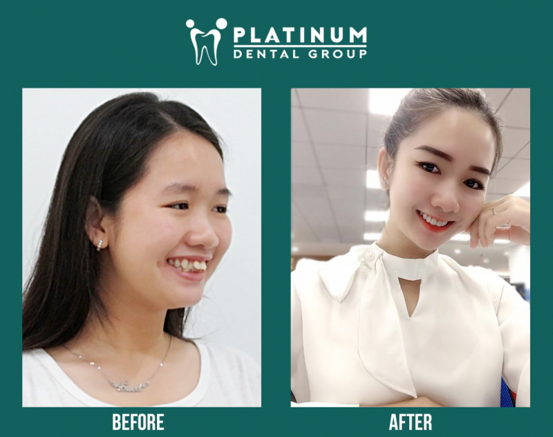 Phòng khám nha khoa Platinum Dental Group