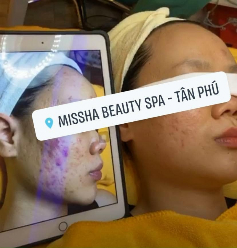 Trung tâm làm đẹp Missha Beauty Spa - Tân Phú, TP.HCM