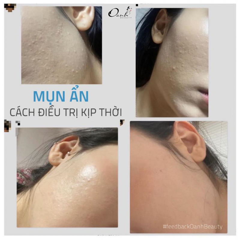 Trung tâm làm đẹp Oanh Beauty Spa - Ba Đình, Hà Nội