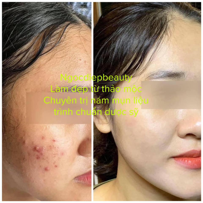 Trung tâm làm đẹp Ngọc Diệp Beauty - Ba Đình, Hà Nội