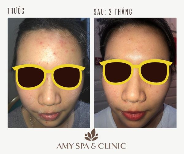 Trung tâm làm đẹp Amy Clinic - Ba Đình, Hà Nội