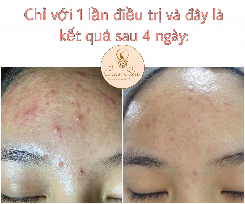 Trung tâm làm đẹp Ciao Spa - Ba Đình, Hà Nội