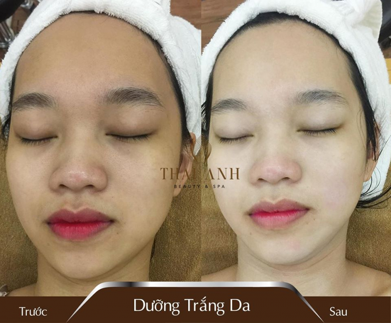 Trung tâm làm đẹp Thai Anh Beauty & Spa - Nam Từ Liêm, Hà Nội