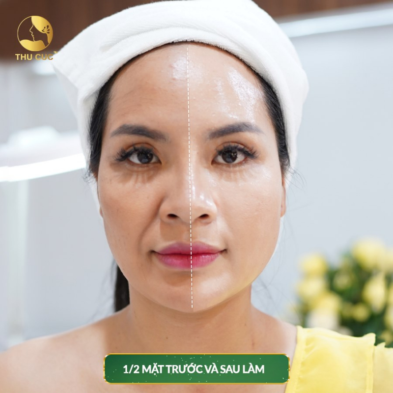 Trung tâm làm đẹp Thu Cúc Clinics - Tây Hồ, Hà Nội