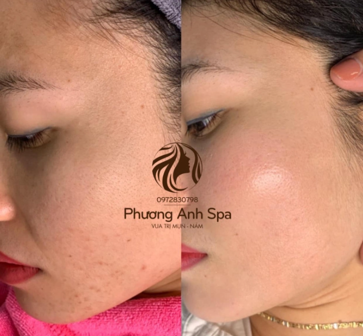 Trung tâm làm đẹp Phương Anh Spa - Mê Linh, Hà Nội