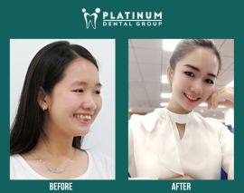 Phòng khám nha khoa Platinum Dental Group - Q.1, TP.HCM