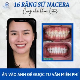 Phòng khám nha khoa Thẩm Mỹ - Lotus Dental - Nam Từ Liêm, Hà Nội